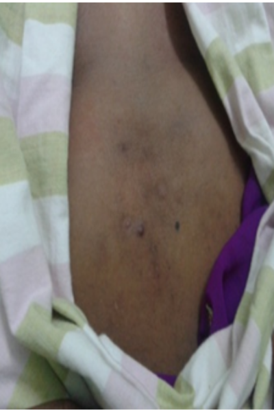 wellcare international hospital trichy wellcare international hospital trichy
