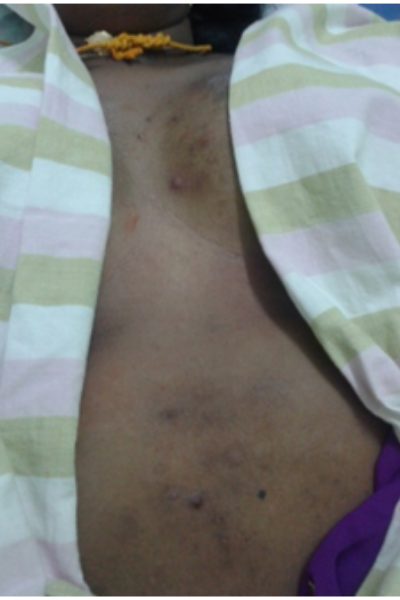 wellcare international hospital trichy wellcare international hospital trichy