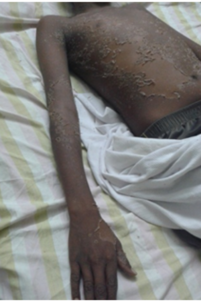wellcare international hospital trichy wellcare international hospital trichy