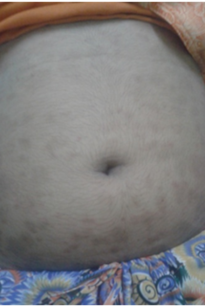 wellcare international hospital trichy wellcare international hospital trichy