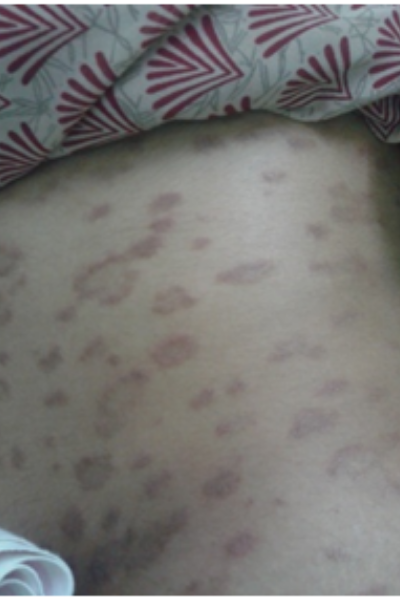 wellcare international hospital trichy wellcare international hospital trichy