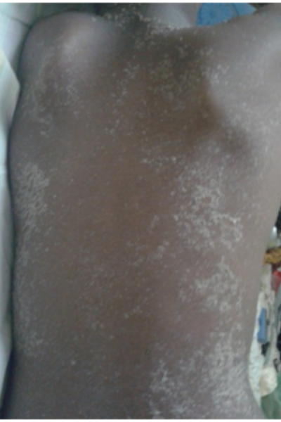 wellcare international hospital trichy wellcare international hospital trichy