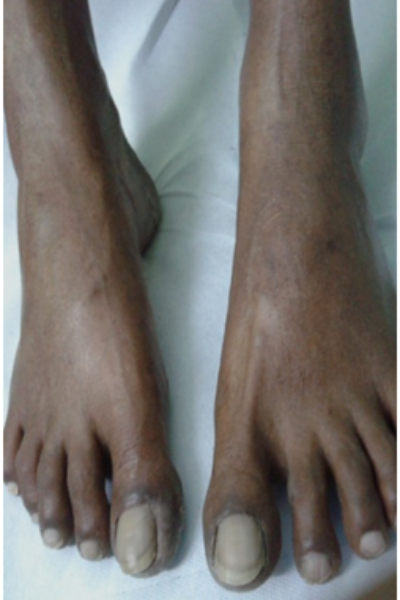 wellcare international hospital trichy wellcare international hospital trichy