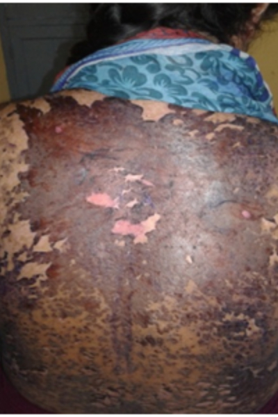 wellcare international hospital trichy wellcare international hospital trichy