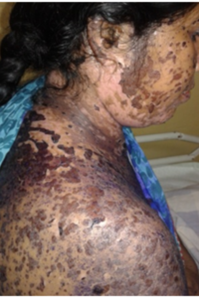 wellcare international hospital trichy wellcare international hospital trichy
