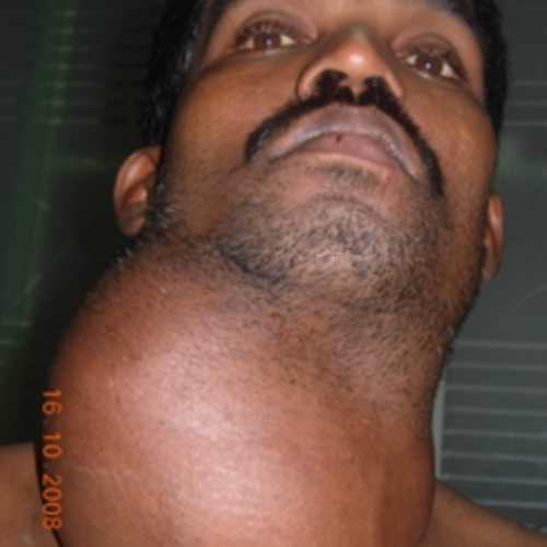 wellcare international hospital trichy wellcare international hospital trichy