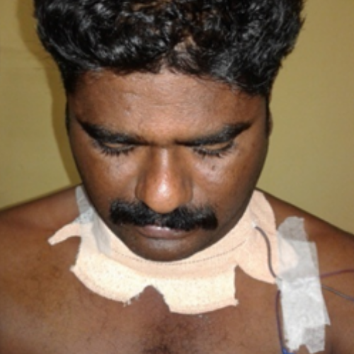 wellcare international hospital trichy wellcare international hospital trichy