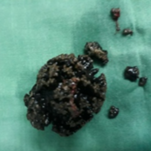 wellcare international hospital trichy wellcare international hospital trichy