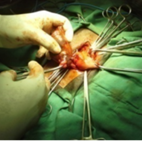 wellcare international hospital trichy wellcare international hospital trichy